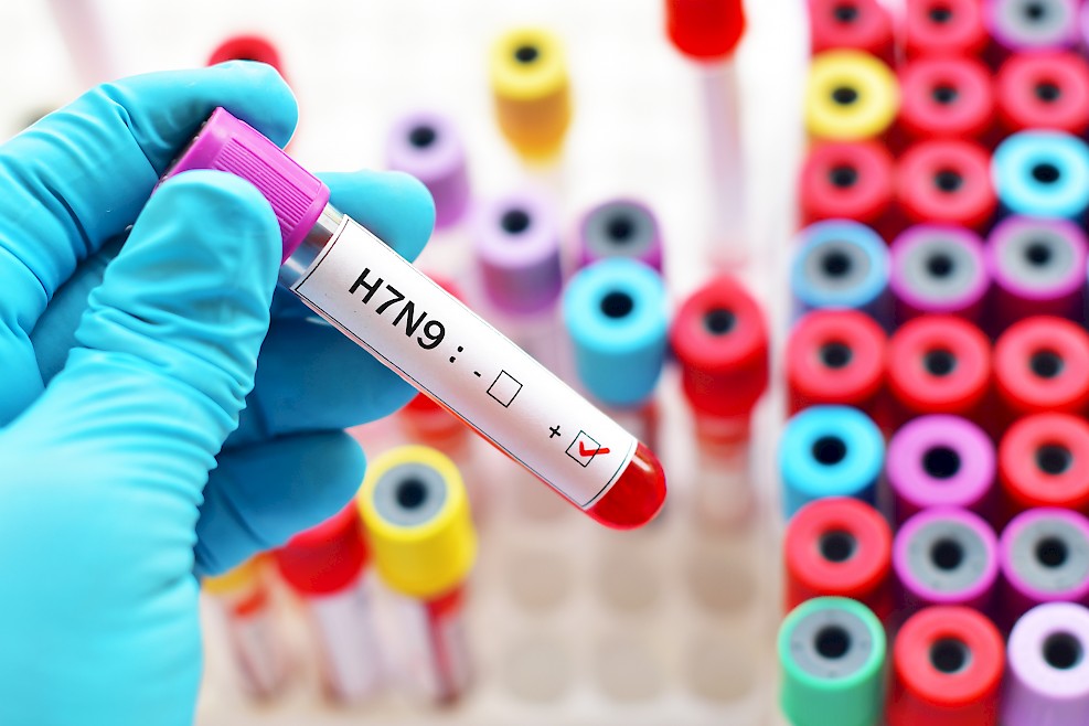 Pandemic Influenza: Advice & Suggestions From an Expert